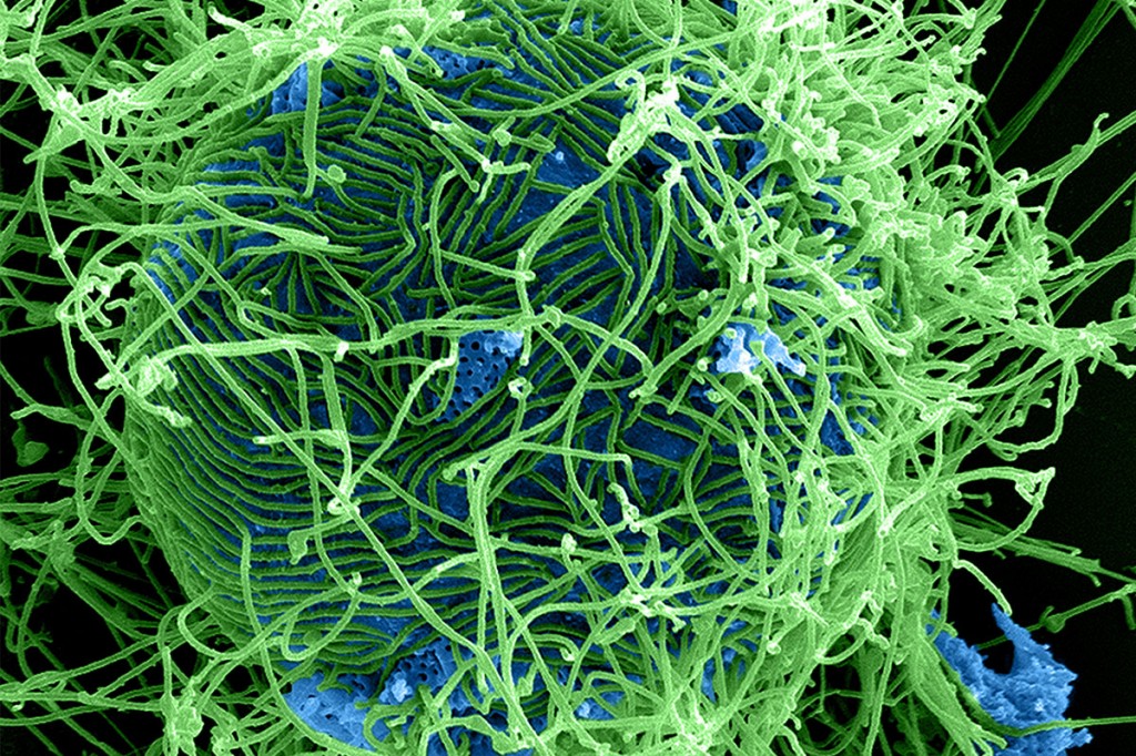 This digitally-colorized scan shows magnetized Ebola virus particles budding from a chronically infected cell. (Photo courtesy of CDC/ National Institute of Allergy and Infectious Diseases)